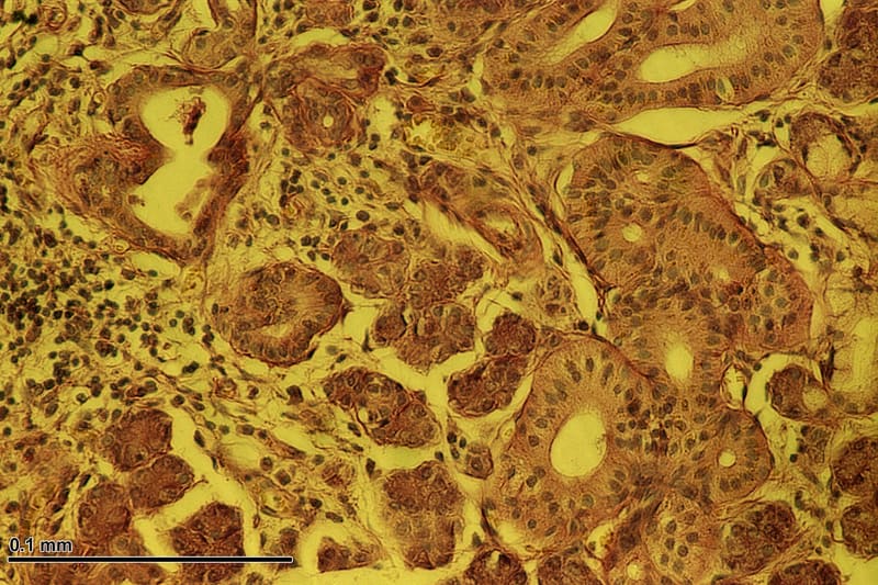 Salivary gland